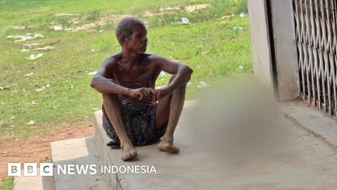 
 Seorang pria di India terpaksa membawa sisa kerangka saudaranya ke bank akibat kebuntuan prosedur birokrasi. (Foto: RSS)